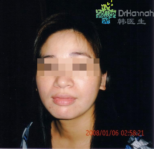 鼠标点击查看大图