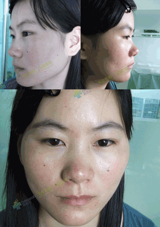 鼠标点击查看大图